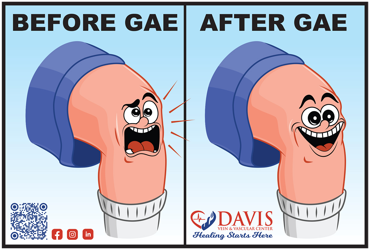 knee pain relief Houston